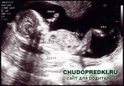 ������������ �� �������. 18-� ������