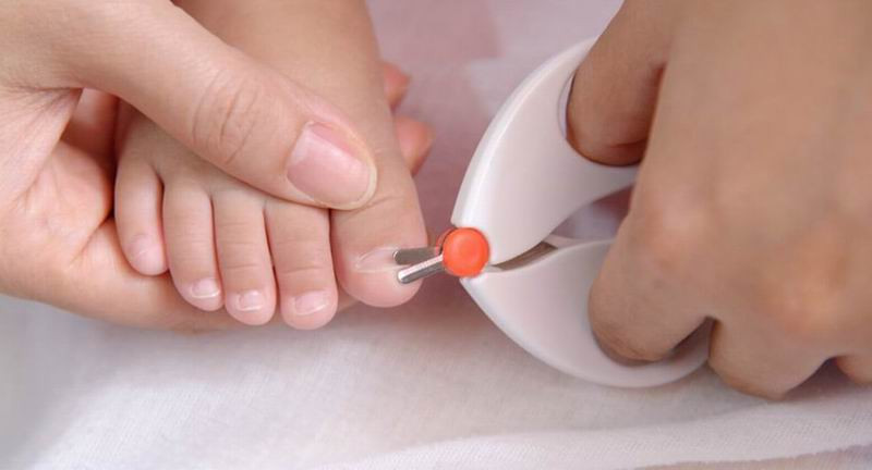 Что делать, если у ребенка врос ноготь на пальце?