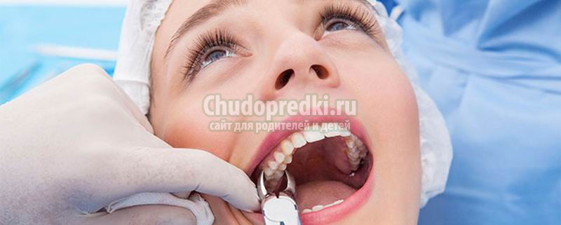Удаление зуба в Москве: быстро, безболезненно и безопасно